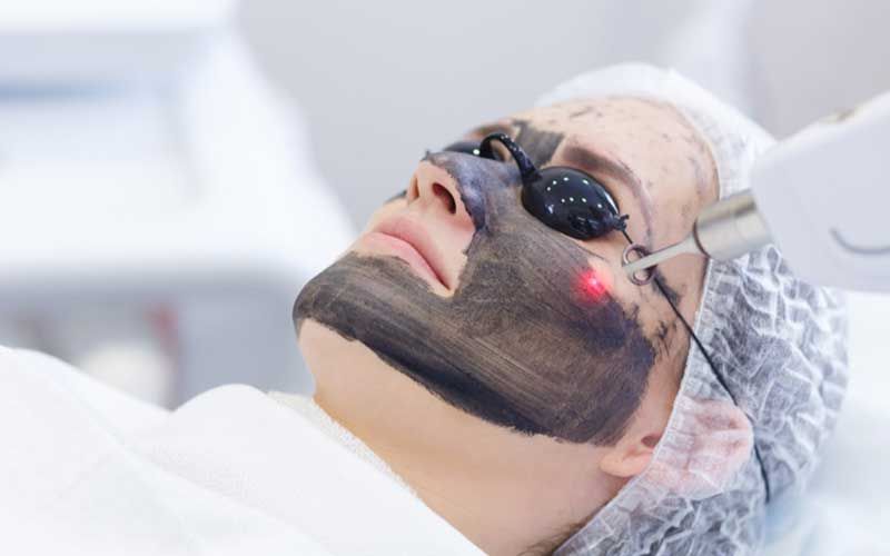 Hollywood Laser Peel.