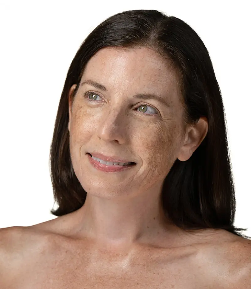 Person with dry skin type.