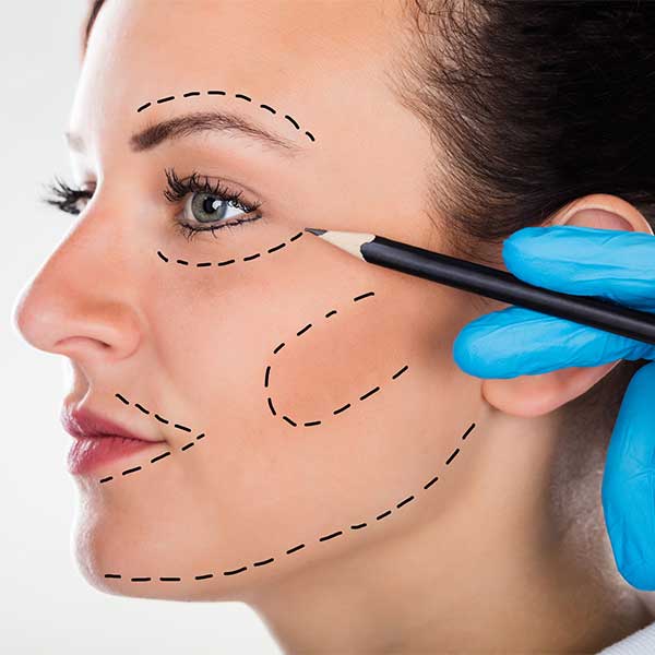 Mapping out microchanneling lines on the face.